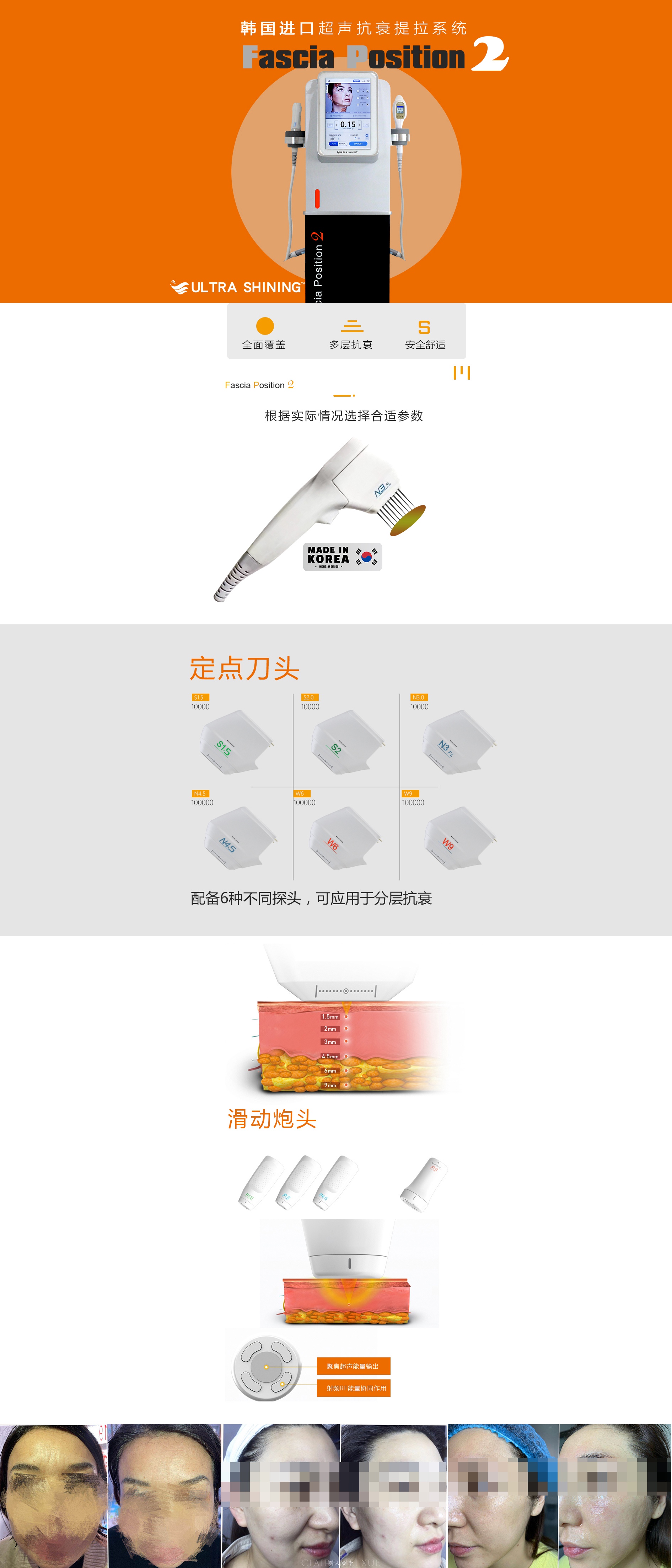 二代超声炮韩国.jpg